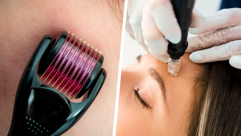 The Ultimate Guide to the Best Microneedle Roller for Radiant Skin